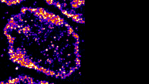 Visualizing the Invisible: New Fluorescent DNA Label Reveals Nanoscopic Cancer Features
