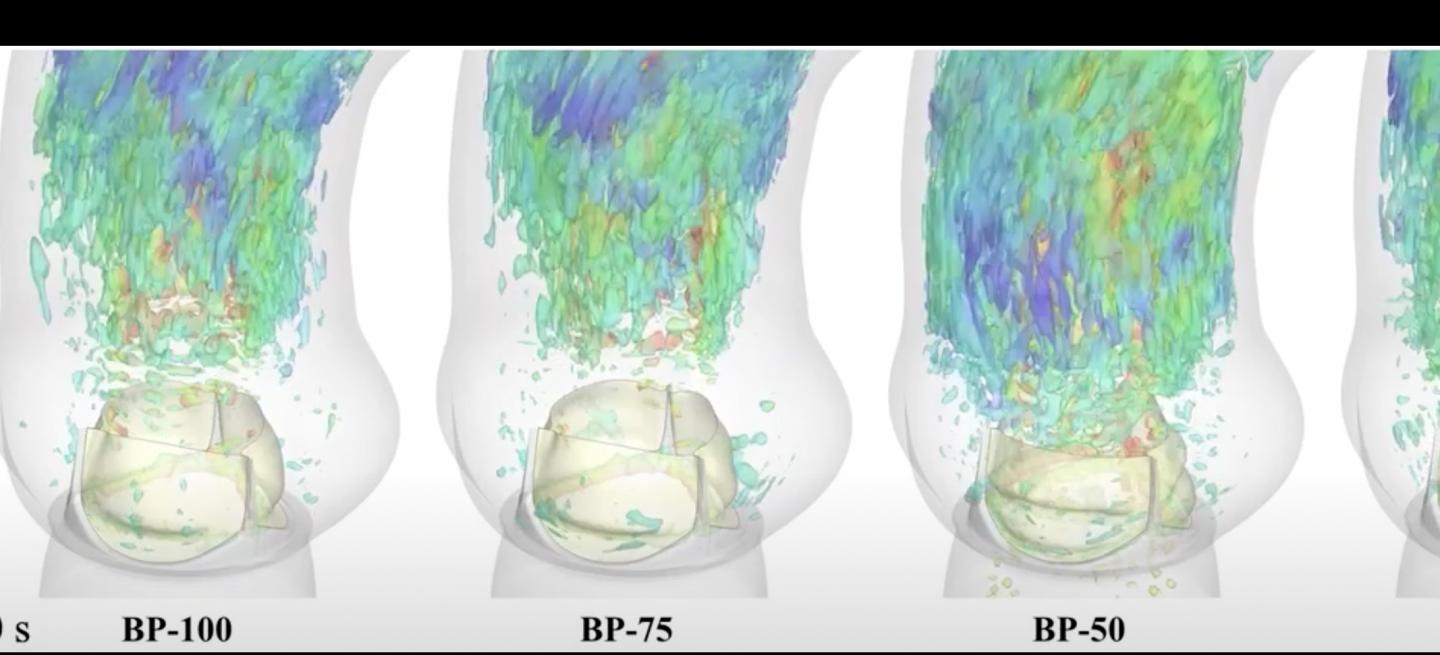 Blood Flow Vortices Generated from Bioprosthetic Aortic Valve Implants