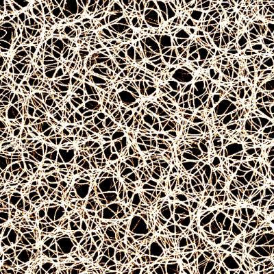 Actin Network Observed Through Confocal Rheometer