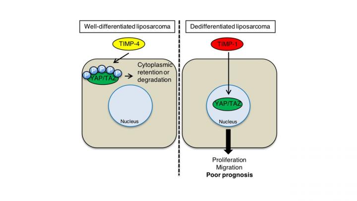 TIMP-1 and TIMP-4 in Liposarcomas