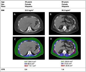 Different body composition in two patients