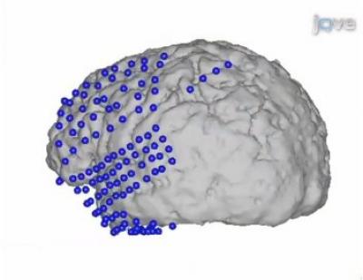 Rendering of Electrodes on the Brain