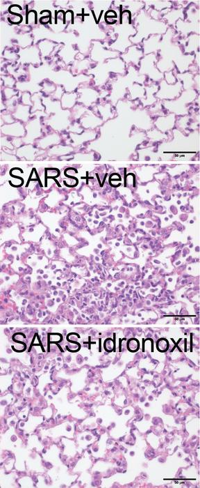 Lung histology - idroxonil