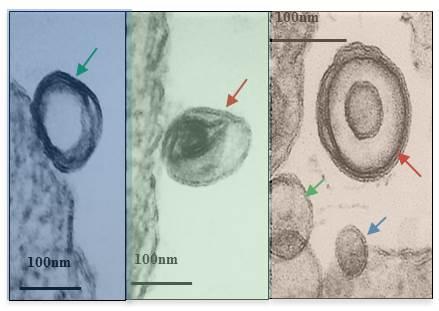 Leishmania RNA Virus 1