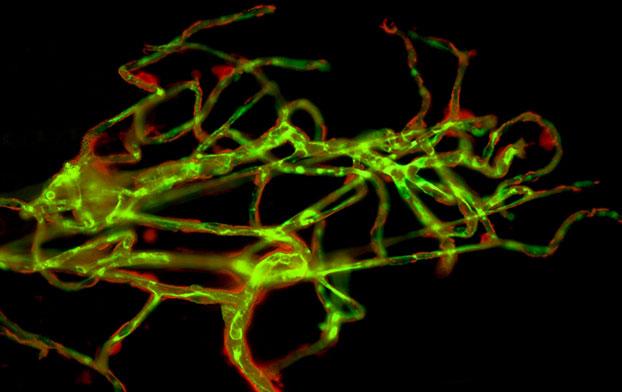 Capillaries from a Mouse Brain