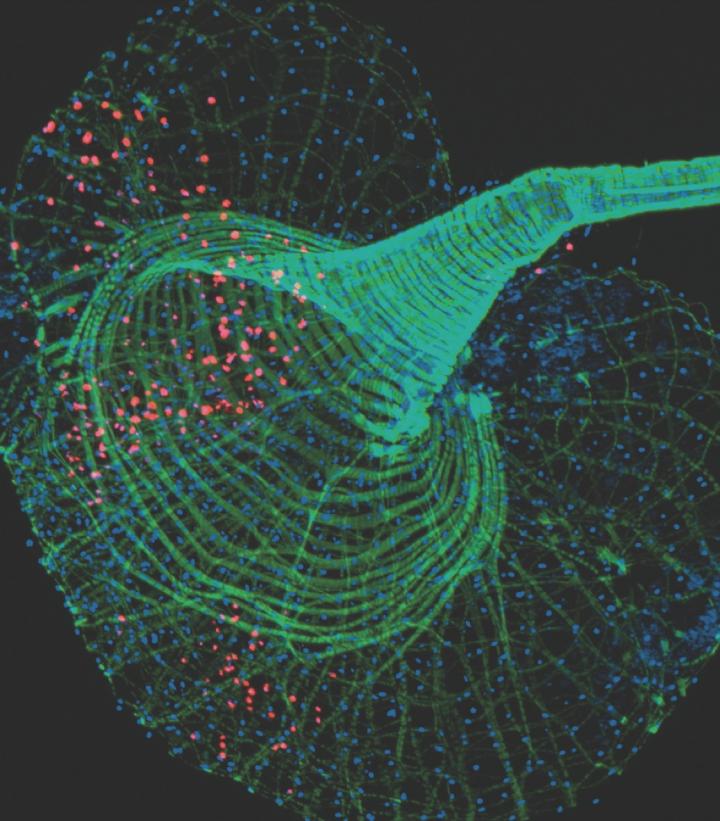 Fruit Fly Infected by the Nora Virus