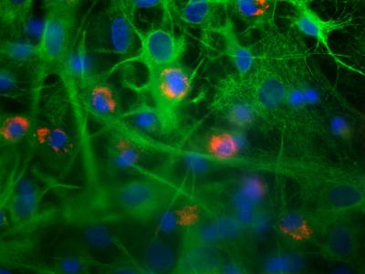 2 Types of Glial Cells