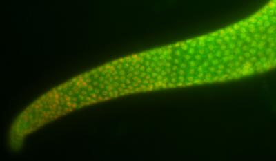 KDM1 Enzyme in a Dissected Worm Gonad