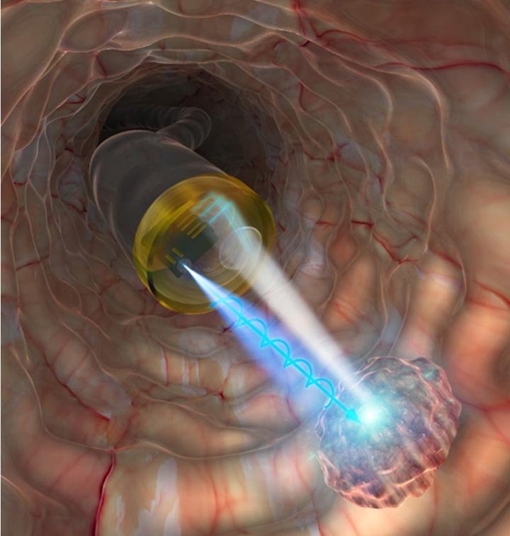 Figure 1. In vivo cancer diagnosis