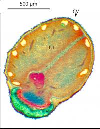 Microscopic Image Showing Structural Cavities in Oxalis Plant