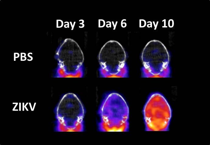 In Vivo PET Imaging Can Detect ZIKV-related Neuroinflammation as Early as Day 3 Post-infection