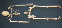 Skeletal Remains (2 of 2)