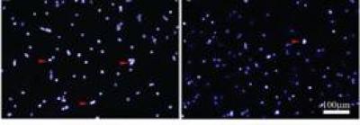Oligomeric Proanthocyanidin