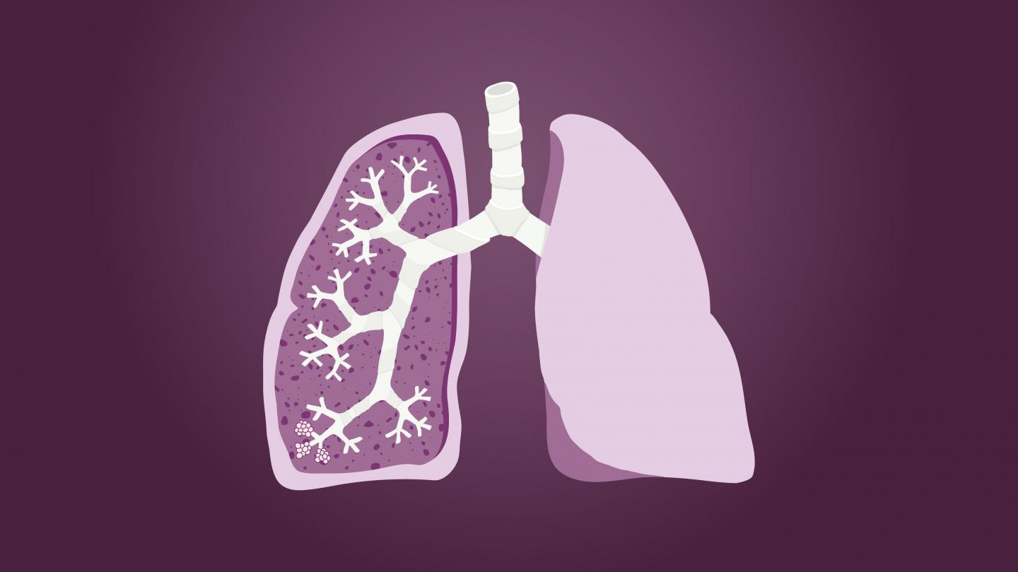 Lungs