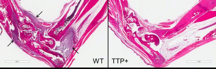 Mice with Higher Levels of TTP Are Protected against Arthritic Inflammation