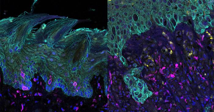 Oral Epithelial Cells