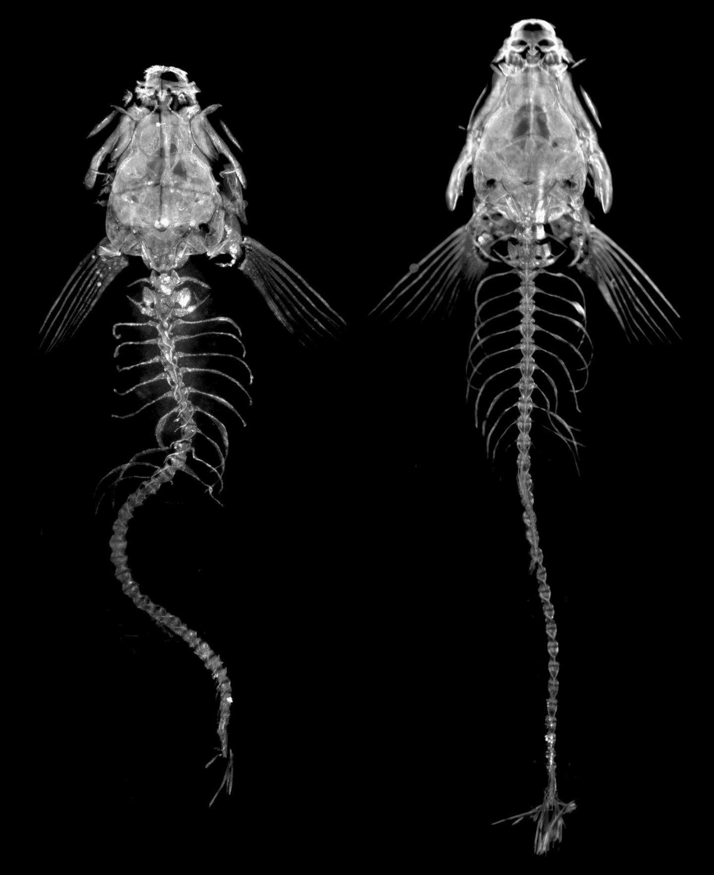 Neuroinflammatory Signals Drive Spinal Curve Formation in Zebrafish Models (1 of 1)