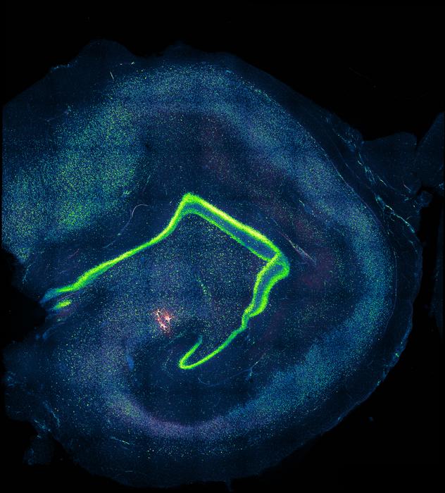 Multicellular CA3 neurons in human hippocampal tissue