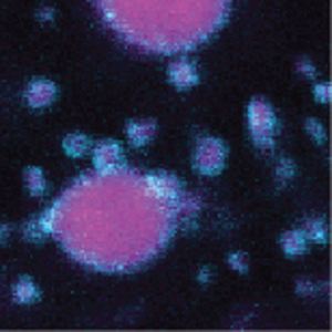 Defective mitochondrial in plant cells with disrupted ATAD3. Interior of mitochondria in pink, ATAD3 on mitochondrial membrane in blue/cyan. The mitochondria are abnormally large.