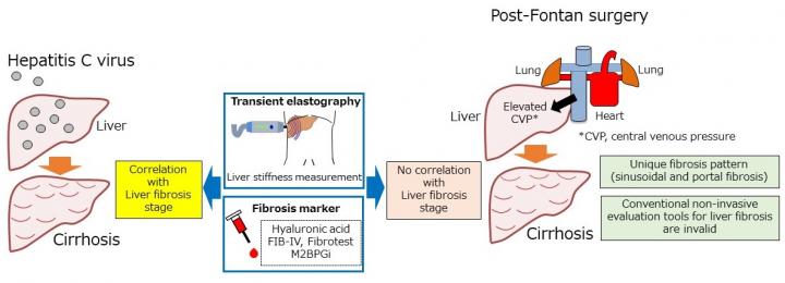 Liver Fibrosis Comparison: Post-Fontan Surgery and Hepatitis C Virus