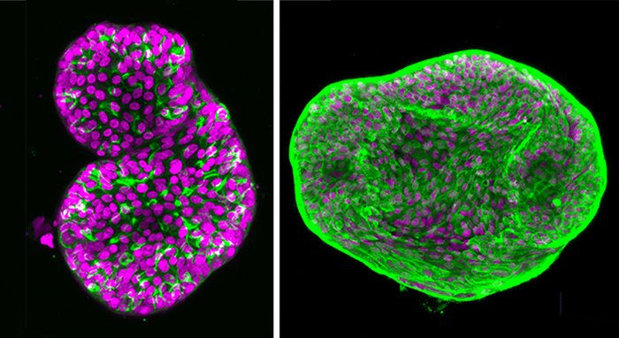 prostate Cancer Organoids