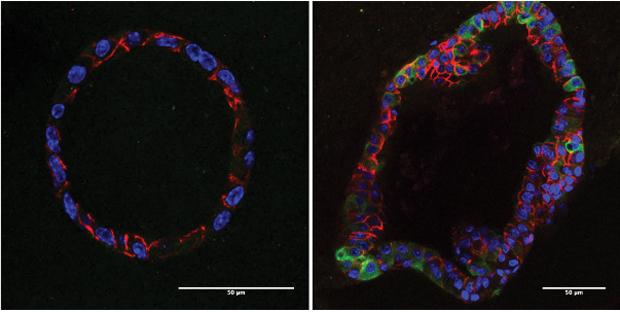 Cells that Drive Breast Cancer Relapse Have Altered Metabolism