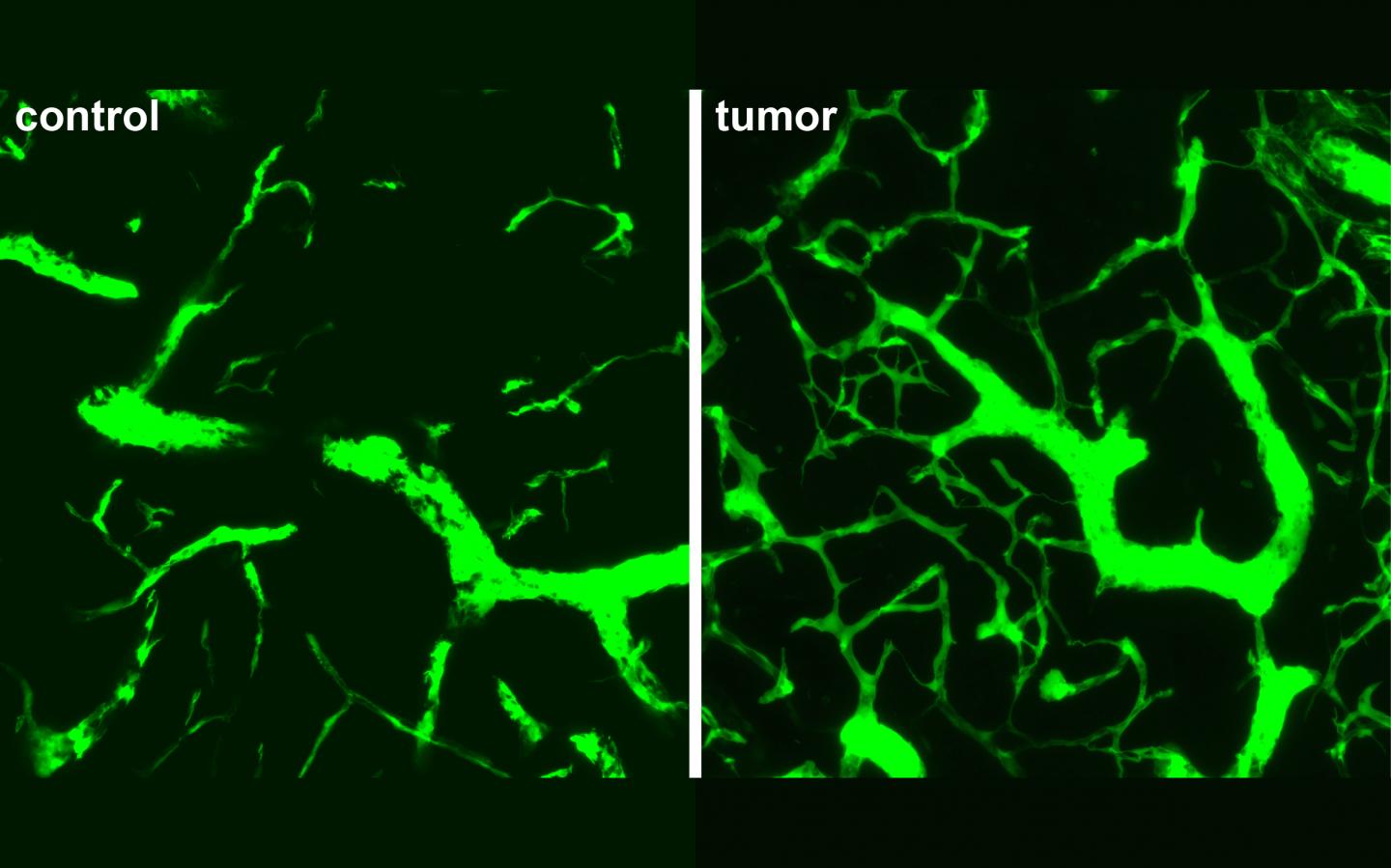 Visualization of Blood Vessels (Green) in Lymph Nodes