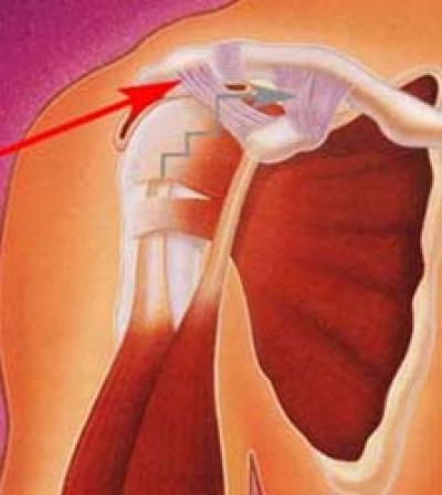 Acromioclavicular Joint Image