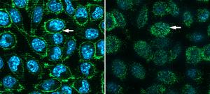 Scientists make COVID receptor protein in mou - Vimarsana News