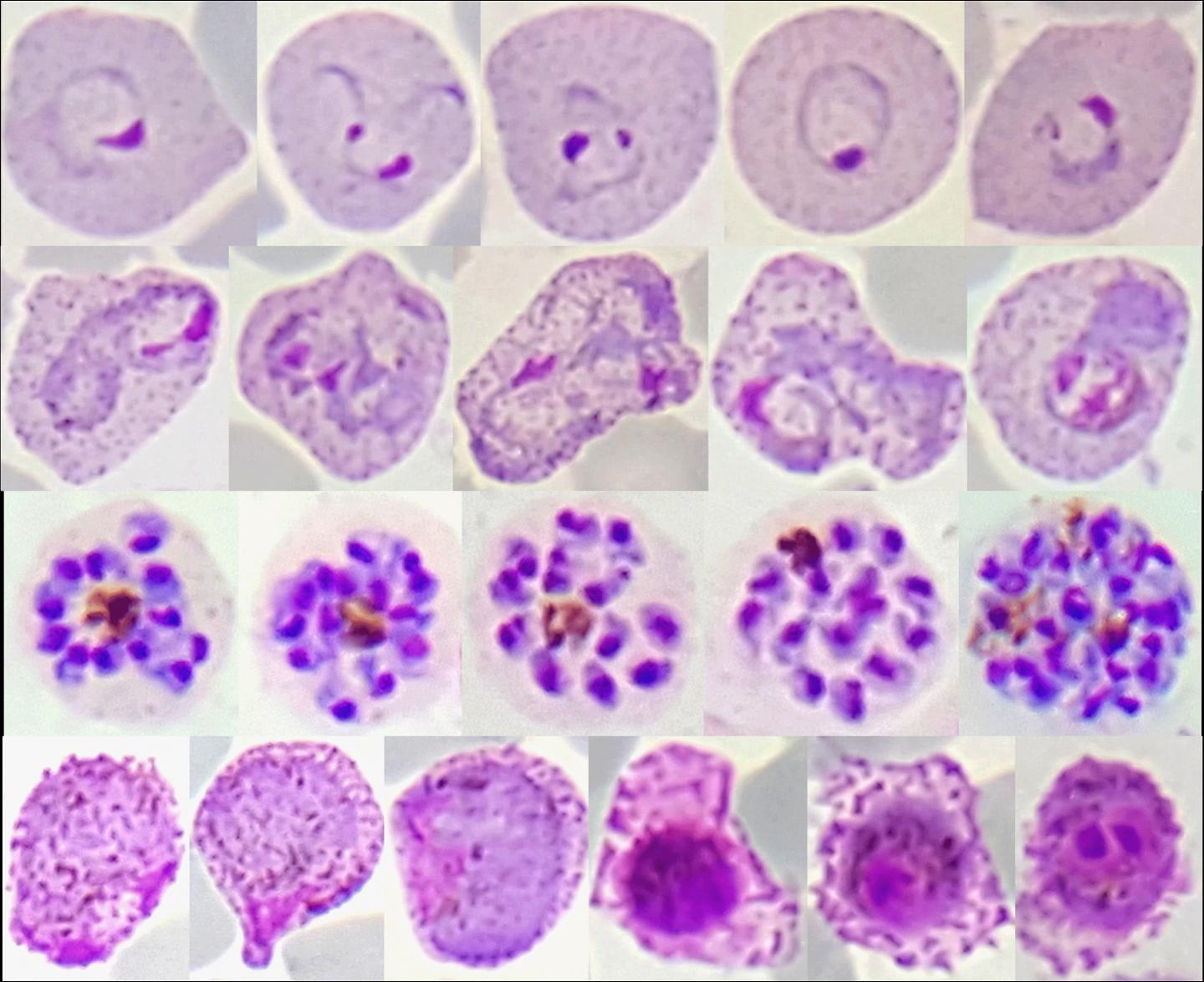 Red Blood Cell Stages of <i>Plasmodium vivax</i>