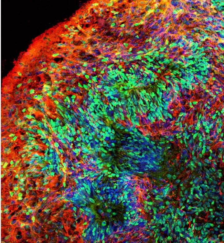 Brain Organoid