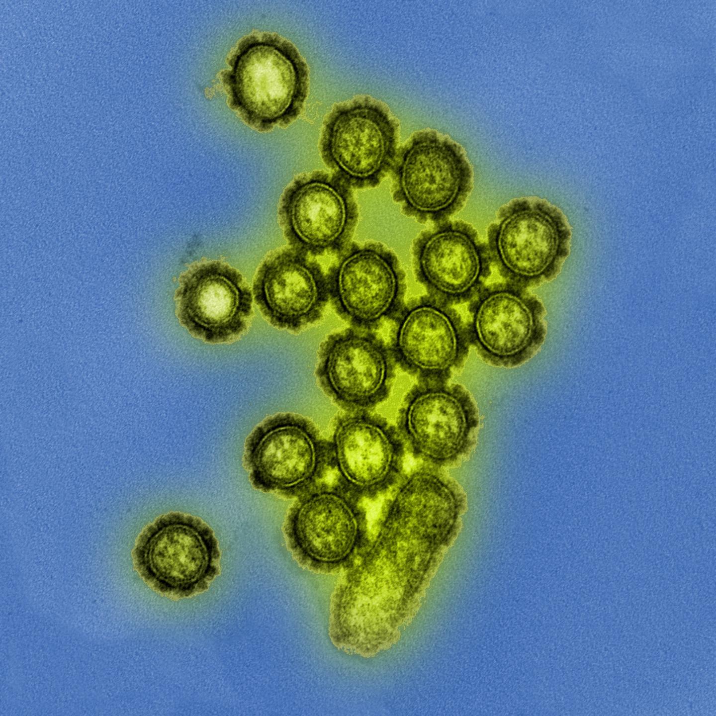H1N1 Influenza Virus Particles