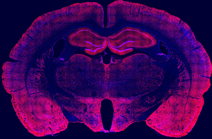 Scripps Research study reveals how alcohol cravings get stronger after drinking during withdrawal