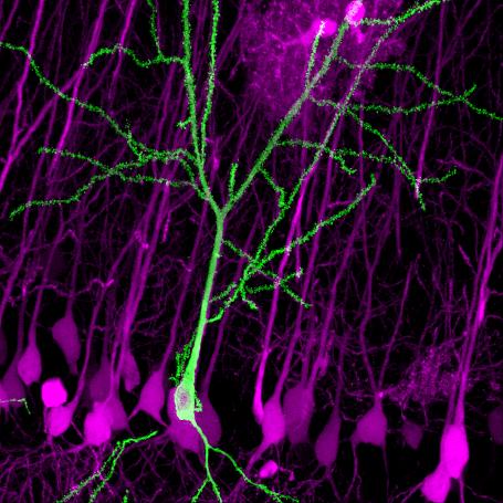The New SLENDR Technique: Protein Labeling in the Developing Brain by Genome Editing