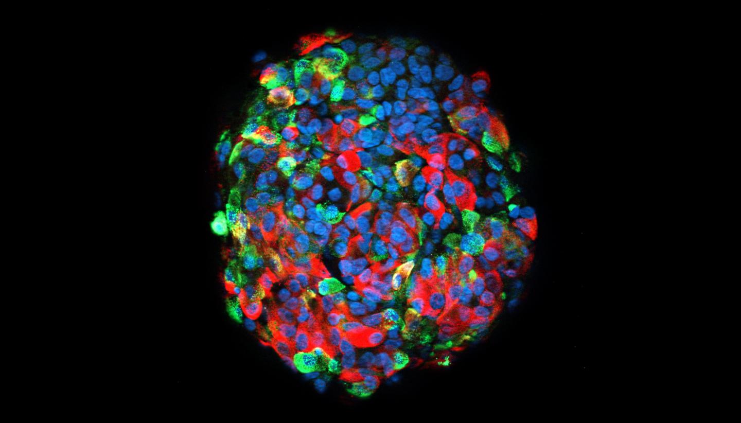 Stem Cell-Derived Beta-Cells [IMAGE] | EurekAlert! Science News Releases