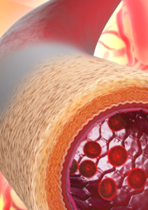 Artist’s impression of the ‘living blood vessel’, featuring the new material