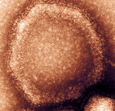 Hendra Virus