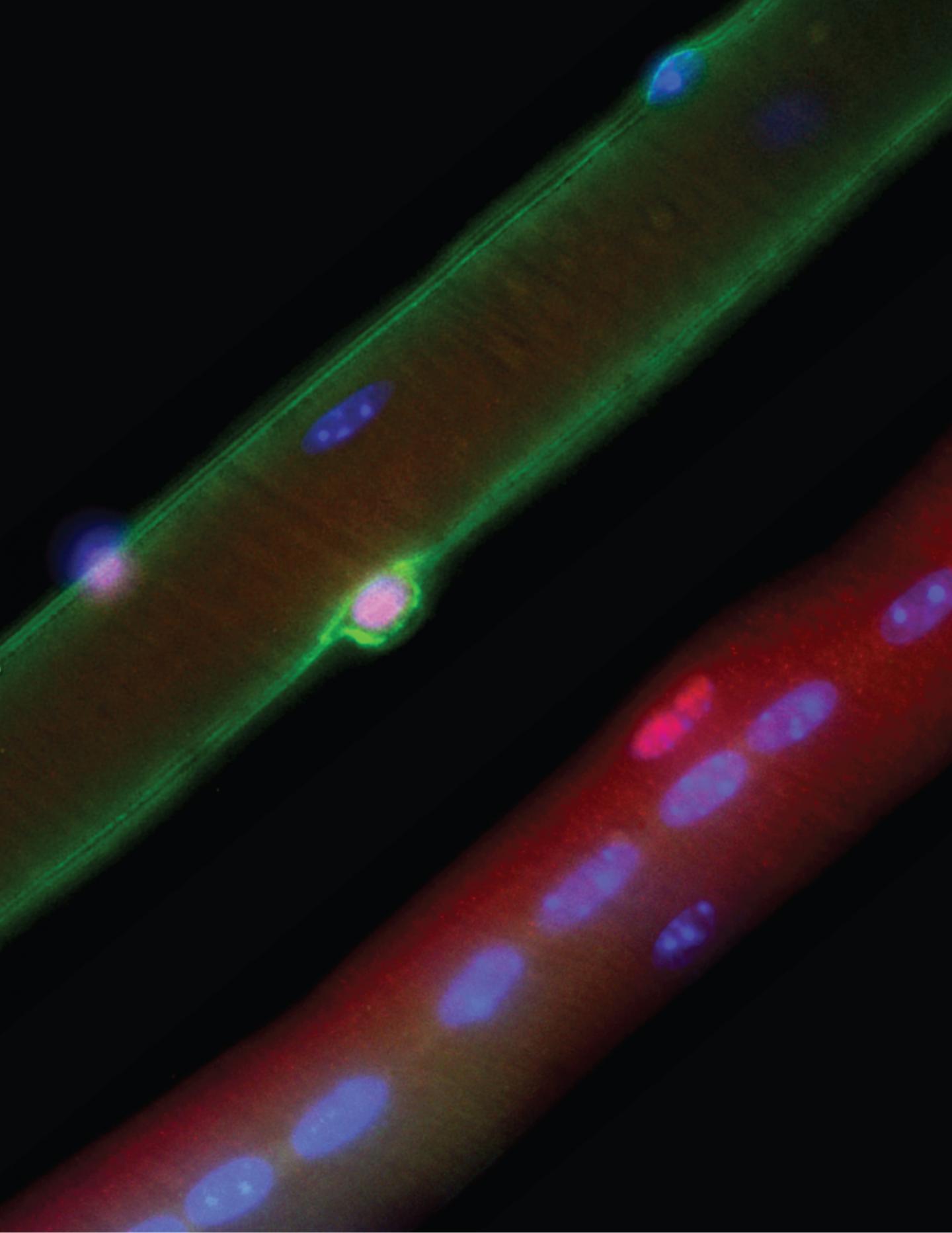 The Loss of Dystrophin (Green) Results in Profound Defects in Muscle Stem Cells (Red)