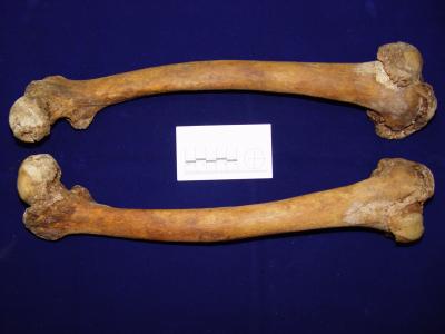 Femur