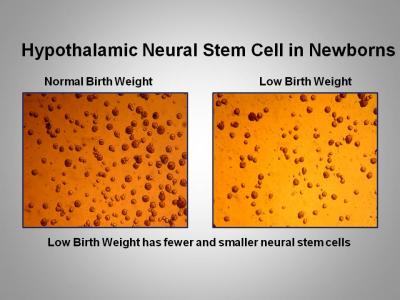 Fewer Neural Cells in Low Birth Weights