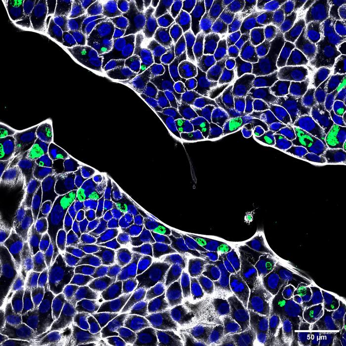 Chlamydia in human gastric cells