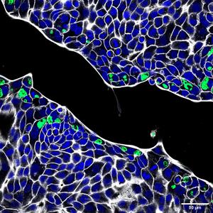 Chlamydia in human gastric cells