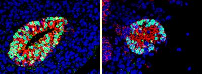 Comparison: Mesenchyme is Reduced, Pancreatic Growth is Impaired