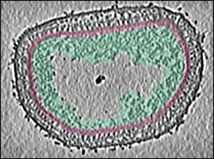 Cryo-electron tomogram of an entire Vaccinia virus. Top view.