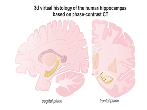DE Search       Avatar image Three-dimensional virtual histology of human hippocampus based on phase-contrast computed tomography
