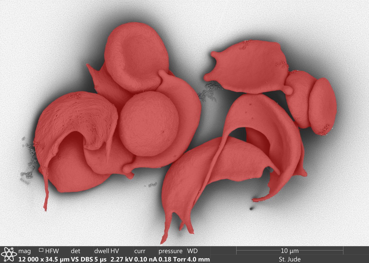 Sickle Cells