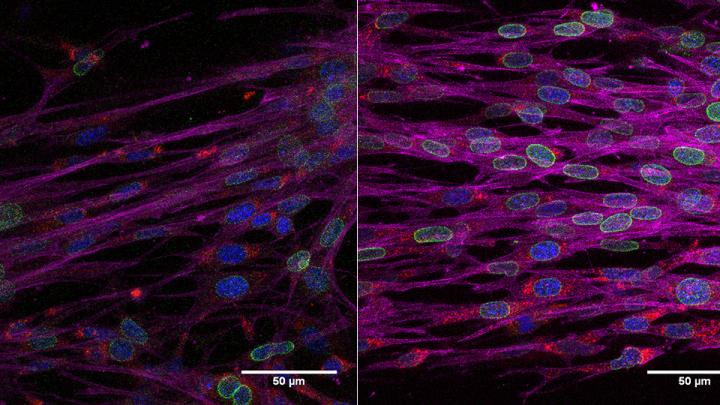 Rejuvenated fibroblasts can recover ability to contract