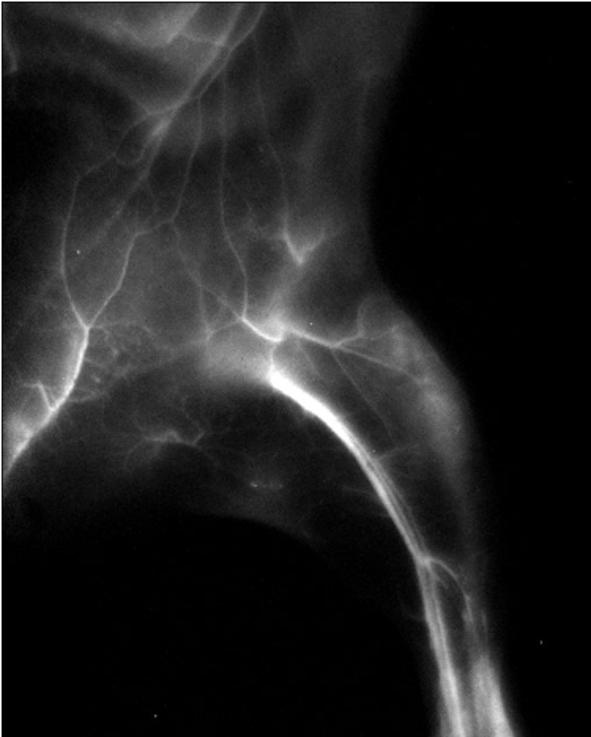 A mouse hindlimb image recorded in NIR-Ib