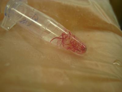 Nematodes Sampled from Gulf of Mexico Beaches Several Months after the Deepwater Horizon Oil Spill o