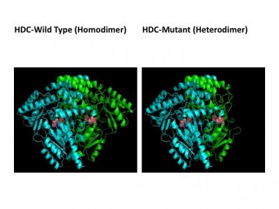 Mutation in HDC Gene